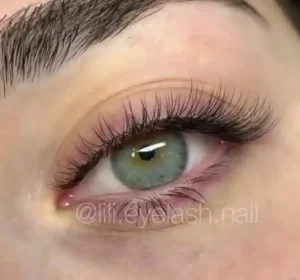 کاشت مژه کلاسیک در اسلامشهر